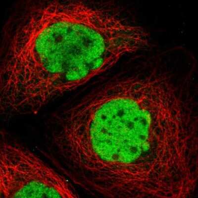 Immunocytochemistry/ Immunofluorescence: c-Fos Antibody [NBP1-89065]