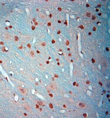 Immunohistochemistry-Paraffin: c-Fos Antibody [NB110-75039]