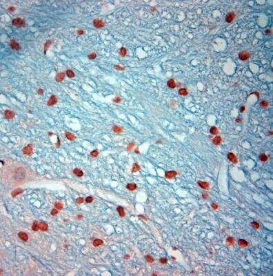 Immunohistochemistry-Paraffin: c-Fos Antibody [NB110-75039]