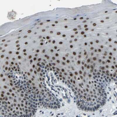 Immunohistochemistry-Paraffin: c-Fos Antibody [NBP1-89065]