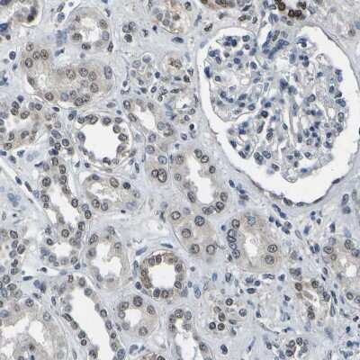 Immunohistochemistry-Paraffin: c-Fos Antibody [NBP1-89065]