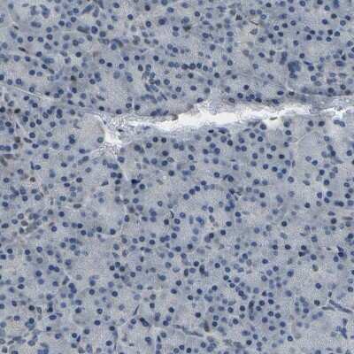 Immunohistochemistry-Paraffin: c-Fos Antibody [NBP1-89065]