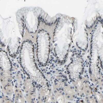 Immunohistochemistry-Paraffin: c-Fos Antibody [NBP1-89065]