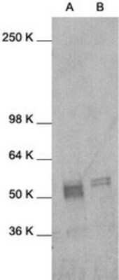 Western Blot: c-Fos Antibody [NB600-904]