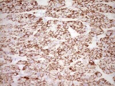 Immunohistochemistry: c-Fos Antibody (OTI7D6) - Azide and BSA Free [NBP2-70764]