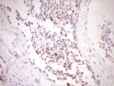 Immunohistochemistry: c-Fos Antibody (OTI7D6) - Azide and BSA Free [NBP2-70764]