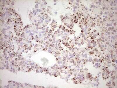 Immunohistochemistry: c-Fos Antibody (OTI7D6) - Azide and BSA Free [NBP2-70764]