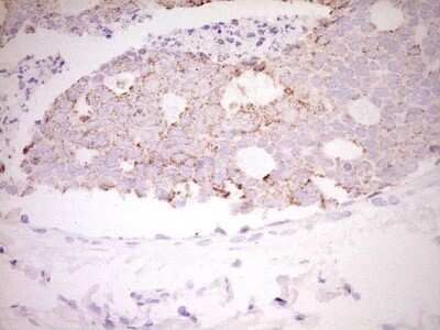 Immunohistochemistry: c-Fos Antibody (OTI7D6) [NBP2-45694]
