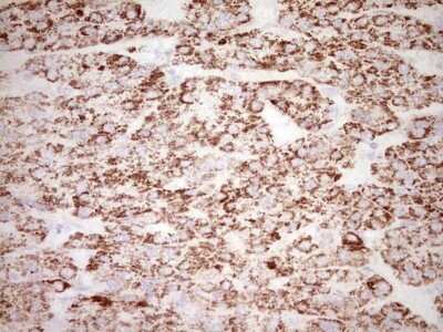 Immunohistochemistry: c-Fos Antibody (OTI7D6) [NBP2-45694]