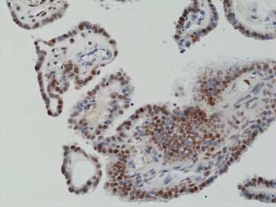 Immunohistochemistry: c-Fos Antibody (RM374) [NBP2-77432]