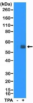 Western Blot: c-Fos Antibody (RM374) [NBP2-77432]