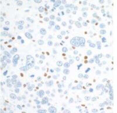 Immunohistochemistry: c-Maf Antibody (BLR045F) [NBP3-14672]