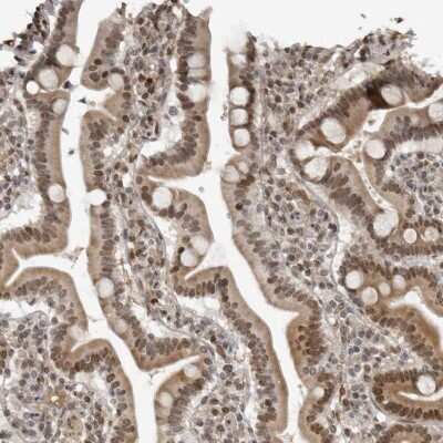 Immunohistochemistry-Paraffin: c-Maf Antibody [NBP1-88072]