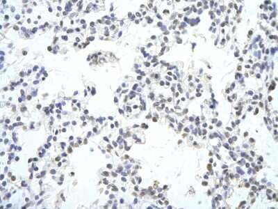 Immunohistochemistry-Paraffin: c-Maf Antibody [NBP3-10482]