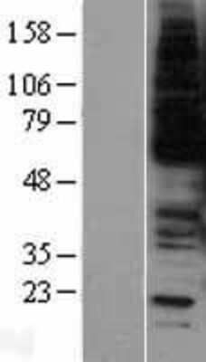 Western Blot: c-Myb Overexpression Lysate [NBL1-13410]