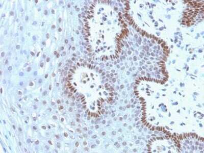 Immunohistochemistry-Paraffin: c-Myc Antibody (9E10.3) - Azide and BSA Free [NBP2-47738]