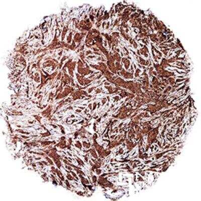Immunohistochemistry-Paraffin: c-Myc Antibody (9E11) - BSA Free [NB200-108]