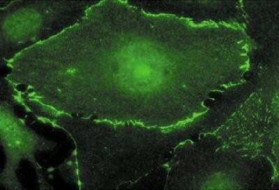 Immunocytochemistry/ Immunofluorescence: c-Myc Antibody [NB600-336]