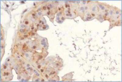 Immunohistochemistry: c-Myc Antibody [NB600-336]