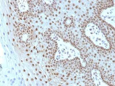 Immunohistochemistry-Paraffin: c-Myc Antibody (MYC275 + MYC909) - Azide and BSA Free [NBP2-47739]