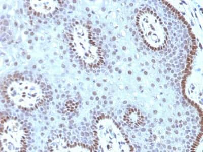 Immunohistochemistry-Paraffin: c-Myc Antibody (MYC909) [NBP2-45146]