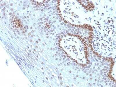 Immunohistochemistry-Paraffin: c-Myc Antibody (SPM237) - Azide and BSA Free [NBP2-86682]