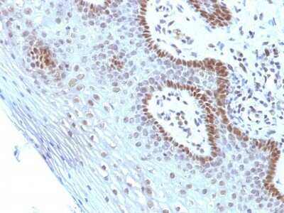 Immunohistochemistry-Paraffin: c-Myc Antibody (SPM237) [NBP2-45145]