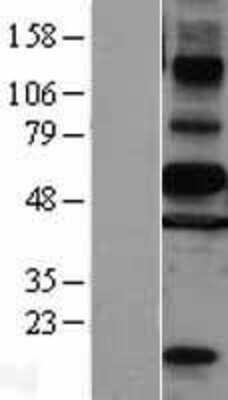 Western Blot: c-Myc Overexpression Lysate [NBL1-13414]