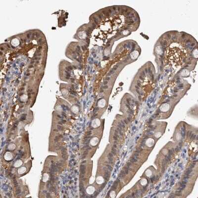 Immunohistochemistry-Paraffin: c-Myc-responsive protein Rcl Antibody [NBP1-85180]