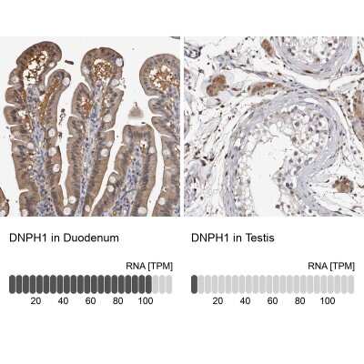 Immunohistochemistry-Paraffin: c-Myc-responsive protein Rcl Antibody [NBP1-85180]