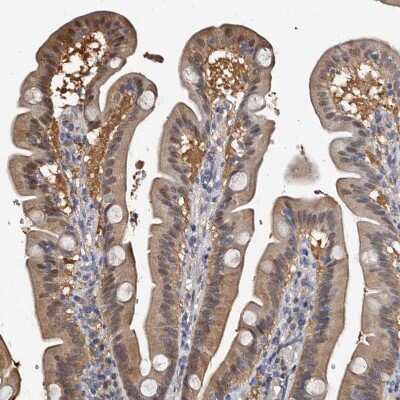 Immunohistochemistry-Paraffin: c-Myc-responsive protein Rcl Antibody [NBP1-85180]