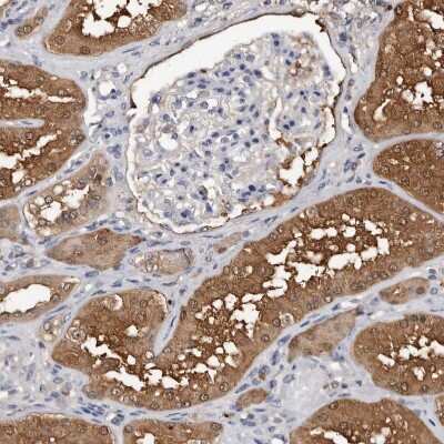 Immunohistochemistry-Paraffin: c-Myc-responsive protein Rcl Antibody [NBP1-85180]