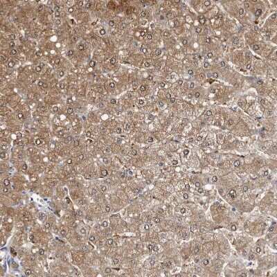 Immunohistochemistry-Paraffin: c-Myc-responsive protein Rcl Antibody [NBP1-85180]