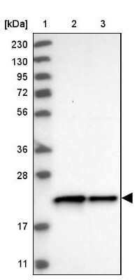 Western Blot: c-Myc-responsive protein Rcl Antibody [NBP1-85180]