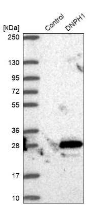 Western Blot: c-Myc-responsive protein Rcl Antibody [NBP1-85181]