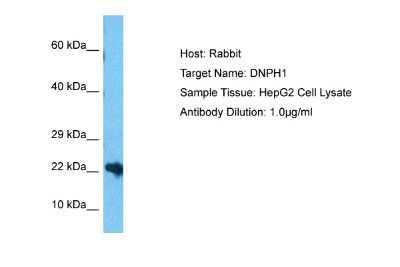 Western Blot: c-Myc-responsive protein Rcl Antibody [NBP2-84699]