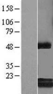 Western Blot: c-Myc-responsive protein Rcl Overexpression Lysate [NBL1-08506]