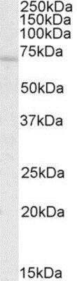 Western Blot: c-Rel Antibody [NBP1-52021]