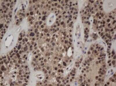 Immunohistochemistry: c-jun Antibody (OTI2D11) [NBP2-45470]