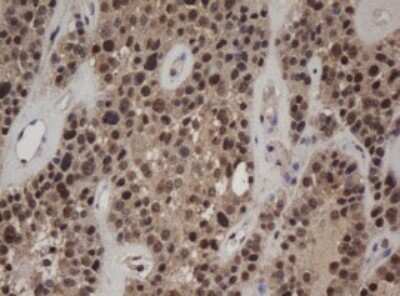 Immunohistochemistry: c-jun Antibody (OTI2D11) - Azide and BSA Free [NBP2-71058]