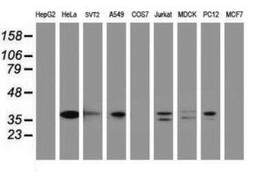 Western Blot: c-jun Antibody (OTI2D11) [NBP2-45470]