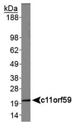 Western Blot: LAMTOR1 Antibody [NBP1-71689]