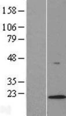 Western Blot: LAMTOR1 Overexpression Lysate [NBL1-08112]