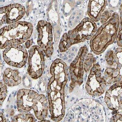 Immunohistochemistry: Eva-1 Homolog C Antibody [NBP1-88936]