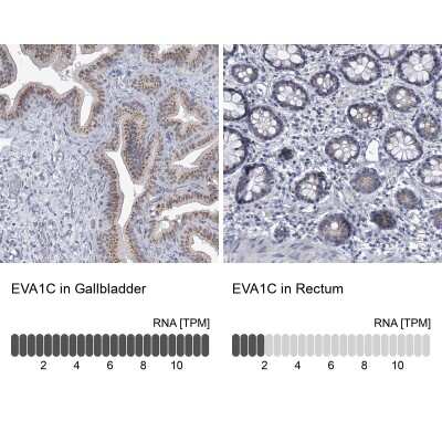 Immunohistochemistry-Paraffin: Eva-1 Homolog C Antibody [NBP1-88937]