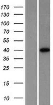 Western Blot: PKA C alpha Overexpression Lysate [NBP2-04478]