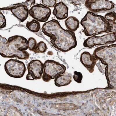 Immunohistochemistry-Paraffin: cGAS Antibody [NBP2-55374]