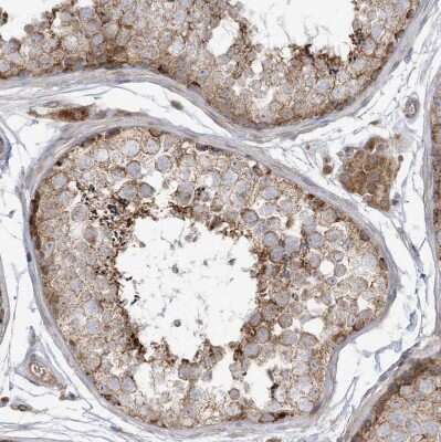 Immunohistochemistry-Paraffin: cGAS Antibody [NBP2-55374]