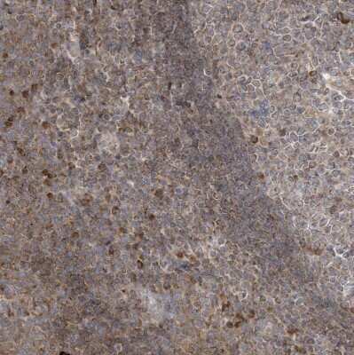 Immunohistochemistry-Paraffin: cGAS Antibody [NBP2-55374]