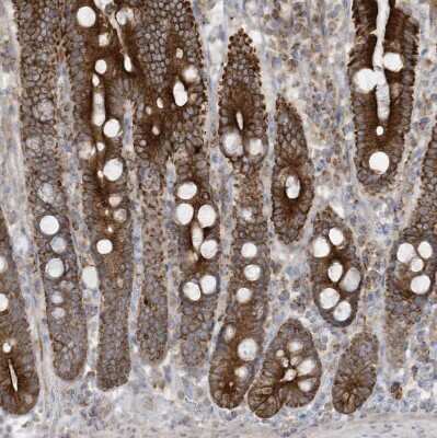 Immunohistochemistry-Paraffin: cGAS Antibody [NBP2-55374]
